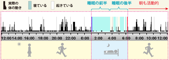 �y�O���t�z�������N���Ă��܂��p�^�[��