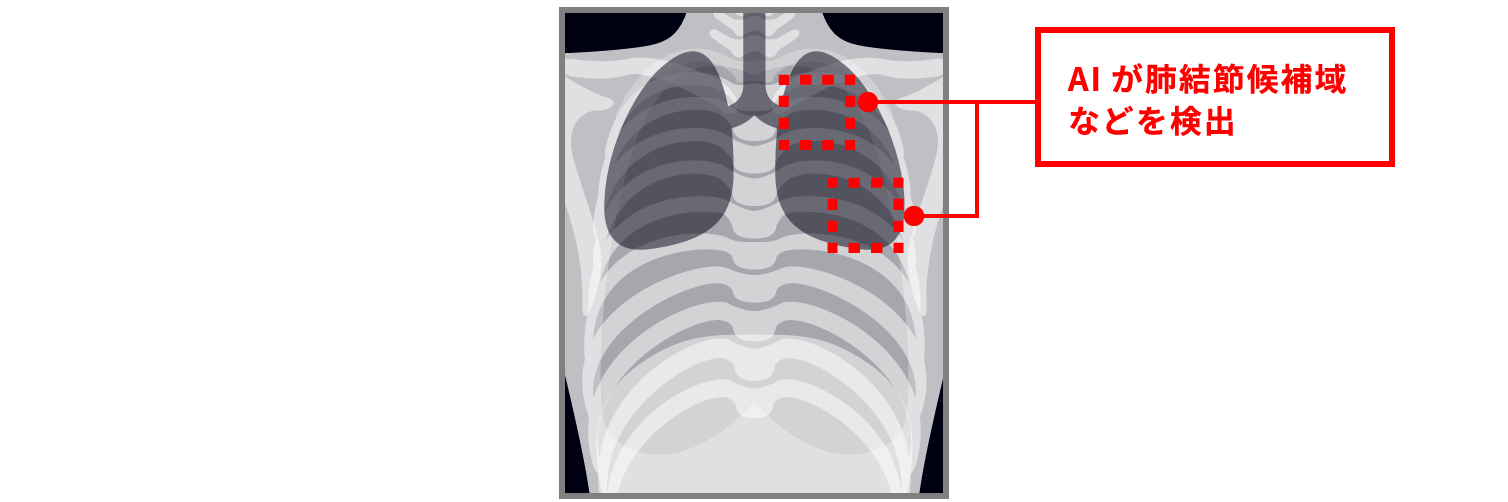 AI���x���ߌ���Ȃǂ����o