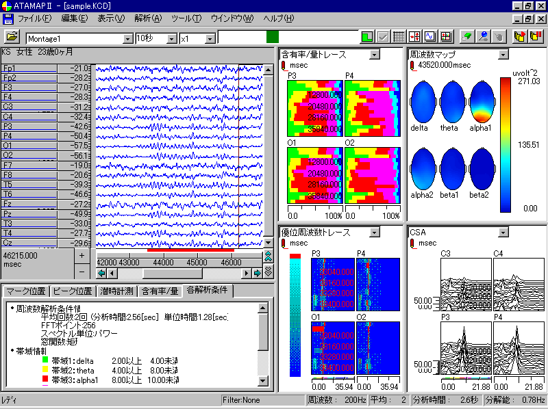 周波数帯域別マップ、CSA、含有率トレース、優位周波数トレース