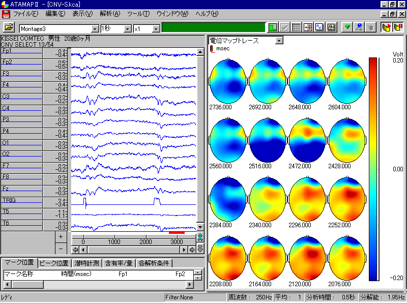 誘発脳波電位マップトレース