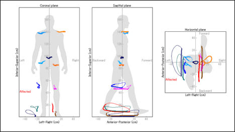 リサジュー外観図
